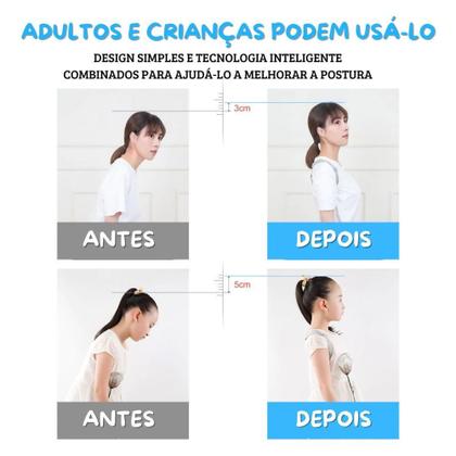 Imagem de Colete Cinta Corretor De Postura Ajustável Sensor Inteligente Vibra Costas Ombro I