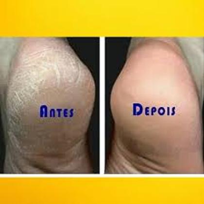 Imagem de Combo creme esfoliante +hidratante para mãos+sebo de carneiro +kit descratavel de pedicure manicure