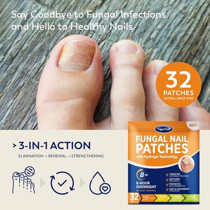 Imagem de Conjunto de força extra para tratamento de fungos nas unhas dos pés VigorWell