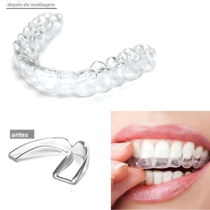 Imagem de Conjunto De Protetores Bucais Transparentes Antirronco De Silicone (4 Peças: 2 Regulares, 2 Grandes)