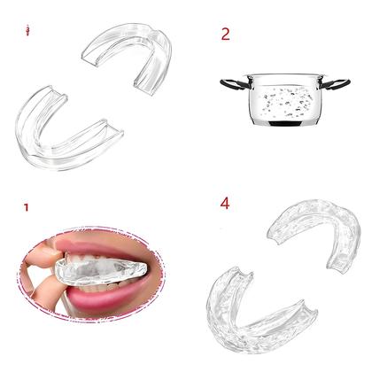 Imagem de Conjunto De Protetores Bucais Transparentes Antirronco De Silicone (4 Peças: 2 Regulares, 2 Grandes)