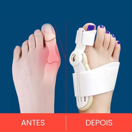 Imagem de Corretor De Joanete Noturno Diurno Com Regulagem 2 Uni. Top