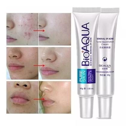 Imagem de Creme Acne Cream Bioaqua Pure Skin para pele oleosa de 30g