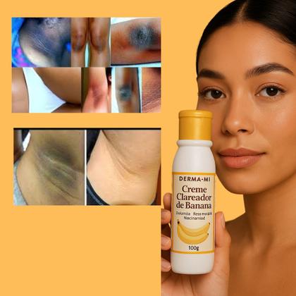 Creme Clareador de Banana 100g Clareia Manchas Escuras, Virilhas ...