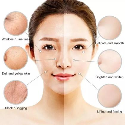 Imagem de Creme Clareador Melasma Manchas Sardas Ebug 20g