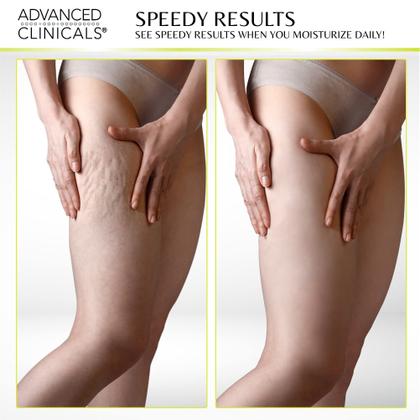 Imagem de Creme Corporal Advanced Clinicals Green Coffee Bean - 480ml