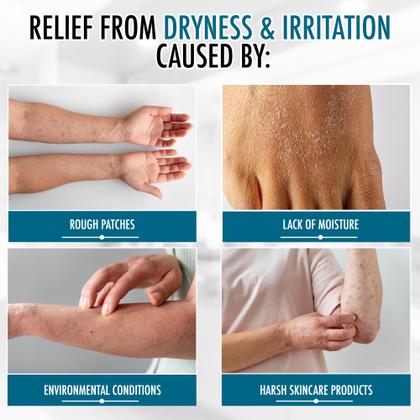 Imagem de Creme Corporal Hidratante GLY MIRACLE para pele seca 355mL