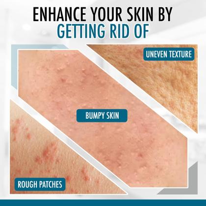 Imagem de Creme Corporal Hidratante GLY MIRACLE para pele seca 355mL