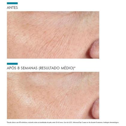 Imagem de Creme Corretor para a Área dos Olhos Skinceuticals A.g.e. Advanced Eye 15ml