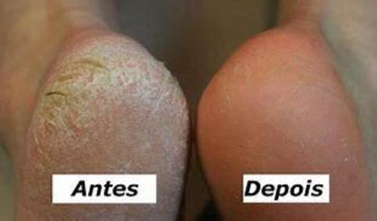 Imagem de Creme Dupé - Natulife 70gr