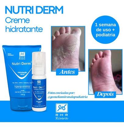 Imagem de Creme Hidratante com Ureia Nutri Derm 30gr