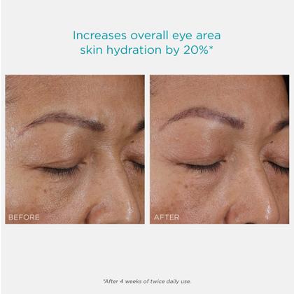 Imagem de Creme para os olhos NEOSTRATA RESTORE Hydra Filling PHA 15 g