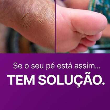 Imagem de Creme Para os Pés Rachados e Ressecados