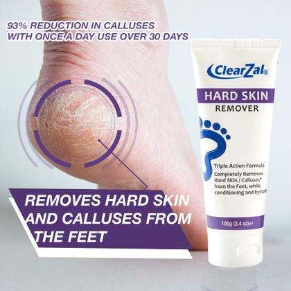 Imagem de Creme para pés ClearZal Hard Skin Caluses Remoção de Milho 100mL