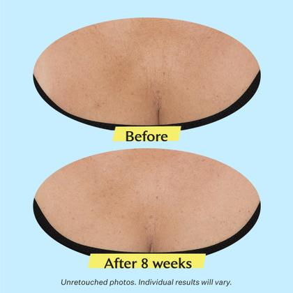 Imagem de Creme para Pescoço StriVectin Tighten & Lift - 100ml