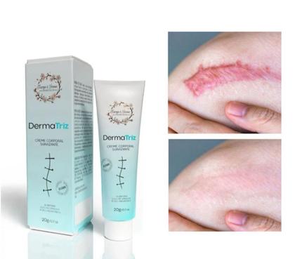 Imagem de Creme Pomada De Estrias Cicatrizes DermaTriz 20g