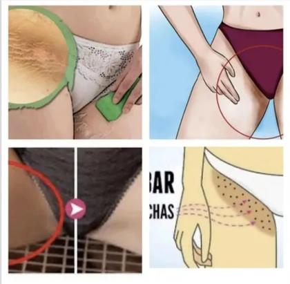 Imagem de Creme Removedor Branqueador De Melasma Melanina NatyFlora