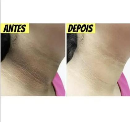 Imagem de Creme Removedor Branqueador De Melasma Melanina NatyFlora