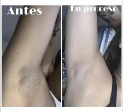 Imagem de Creme Removedor Branqueador De Melasma Melanina NatyFlora