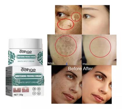 Imagem de Creme Removedor Clareador Sardas Melasma 30g Eelhoe.