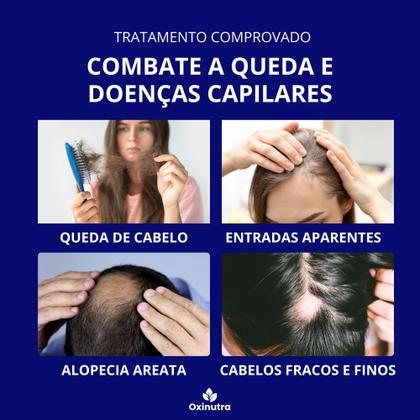 Imagem de Crescimento capilar 500mg dermoxidil