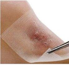 Imagem de Curativo Emulsão Petrolatum Malha Placa Compressa 7,6 X 20,3 2 Envelopes com 1 Unidade cada