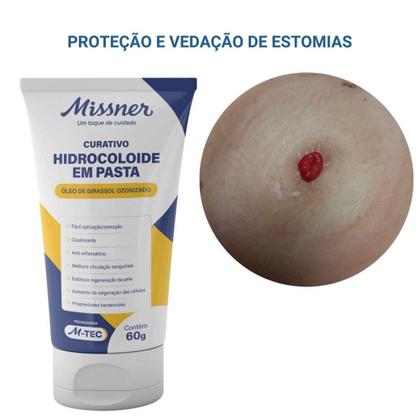 Imagem de Curativo Hidrocoloide em Pasta M-TEC 60G PA. 1463 Missner