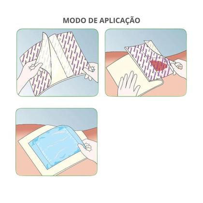 Imagem de Curativo Mepilex Lite Espuma de Silicone 20cm x 50cm 284500 Molnlycke 1 Un