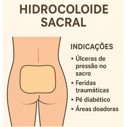 Imagem de Curativo Placa Hidrocoloide Sacral Lombar Feridas Escaras Grande 20x20 - 1 Unidade