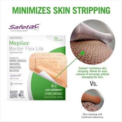 Imagem de Curativos hospitalares Mepilex Border Flex Lite 10x10cm