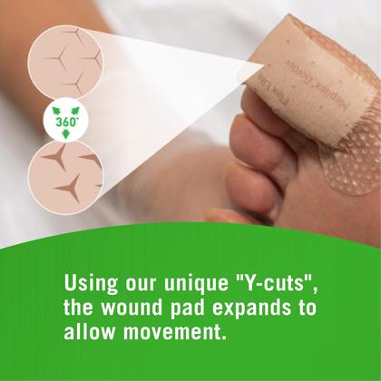 Imagem de Curativos hospitalares Mepilex Border Flex Lite 10x10cm