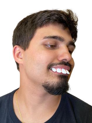 Imagem de Dentadura Dente Grande Fantasia Ronaldinho Dentão engraçado