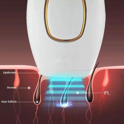 Imagem de Depilador Profissional À Laser IPL 600.000 Flash, 5 Níveis Luz Pulsadad