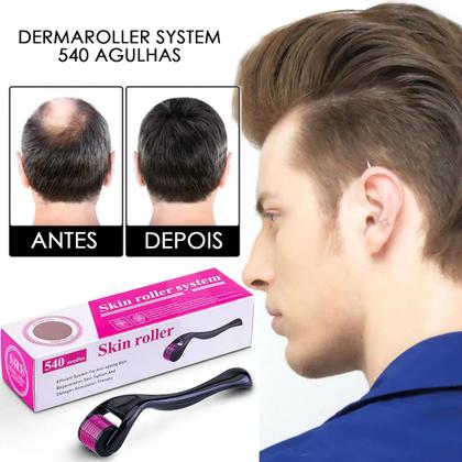 Imagem de Dermaroller Derma System 540 Agulhas De 0,5mm Derma Roller