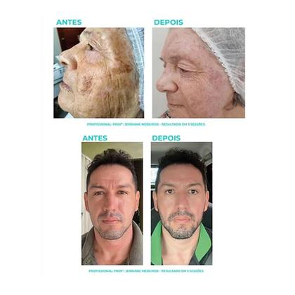 Imagem de Dermoplastic Exo Peel Peeling Exossoma Cosmobeauty 