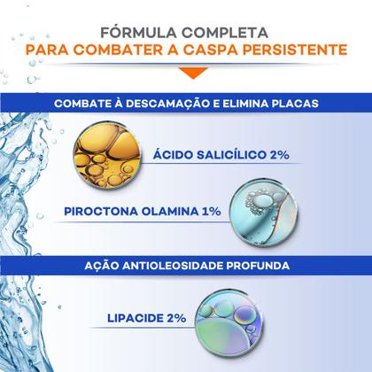 Imagem de Doctar Salic Shampoo Anticaspa Darrow 140ml