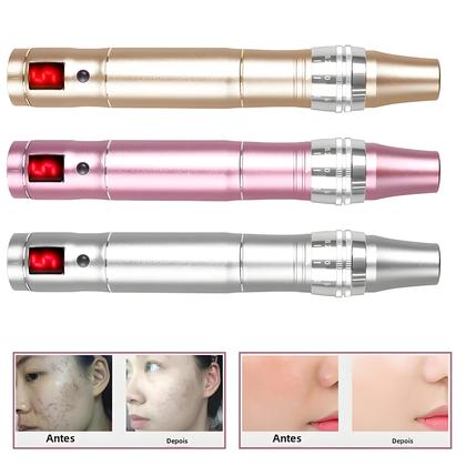 Imagem de Dr.pen Ultima - Caneta de Microagulhamento Sem Fio para Mesoterapia