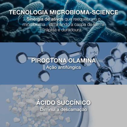 Imagem de Ducray Kelual S Squanorm Shampoo Anticaspa para Cabelos Secos