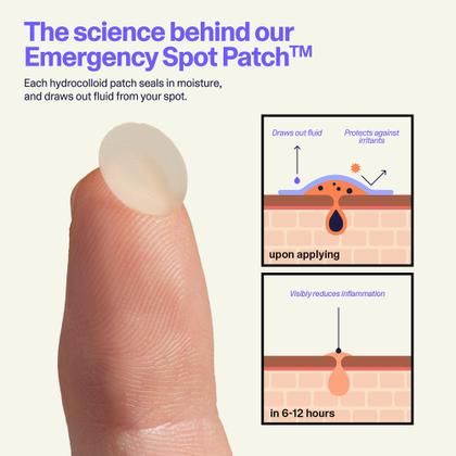 Imagem de Emergency Spot Patch Curology Hydrocolloid Pimple 80 unidades