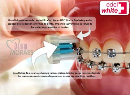 Imagem de ESCOVA DE DENTES ORTODÔNTICA PRO ORTHO EDEL WHITE - 2 un