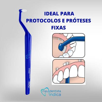 Escova Dental Universal Care Tepe Ideal p/ implantes unidade