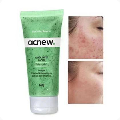 Imagem de Esfoliante Facial Antiacne Remove Pontos Negros Cravos Controla Oleosidade Acnew Abelha Rainha 60g REF 3754