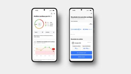 Imagem de Estetoscópio Digital com IA Skeeper MD  Ausculta Inteligente Profissional