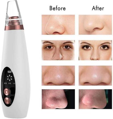 Imagem de Extrator Cravos Aparelho Removedor A Vácuo Recarregável 6