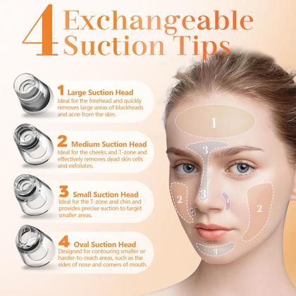 Imagem de Extrator de poros, removedor de cravos a vácuo Yccu com 5 cabeças de sucção