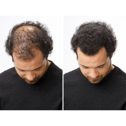 Imagem de Fibra Capilar Preto ou Castanho Maquiagem Para Cabelo Queratina Natural