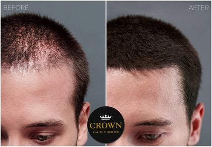 Imagem de Fibras Capilares CROWN TWENTY1 2x28 g Preto