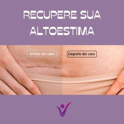 Imagem de Fita Lâmina Gel Cicatrização Anti Quelóide Pós Operatório  40x3cm