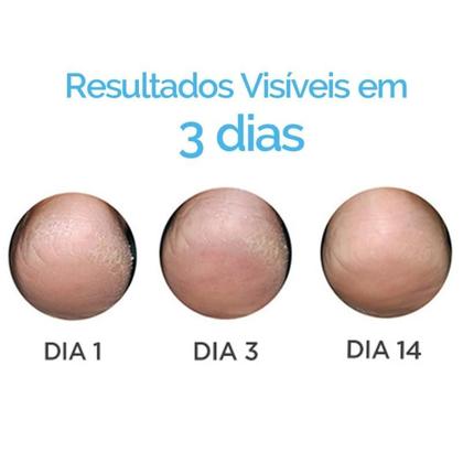 Imagem de Gel Oil Hidratante ISDIN Ureadin Podos 75ml