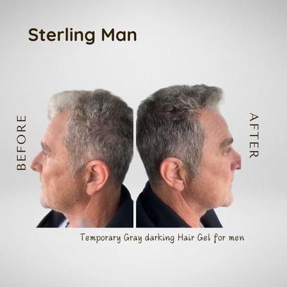 Imagem de Gel para Cabelo Sterling Man Escurecimento dos Cabelos Grisalhos Fixação Média 162 ml